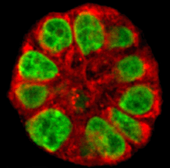 Image: A live human mammary gland structure created in research that uses a new imaging technology to reveal subtle changes in breast tissue, representing a potential tool to determine a woman's risk of developing breast cancer and to study ways of preventing the disease. Unlike conventional cell cultures, the 3-D cultures have the round shape of milk-producing glands and behave like real tissue (Photo courtesy of Purdue University /Shuhua Yue).